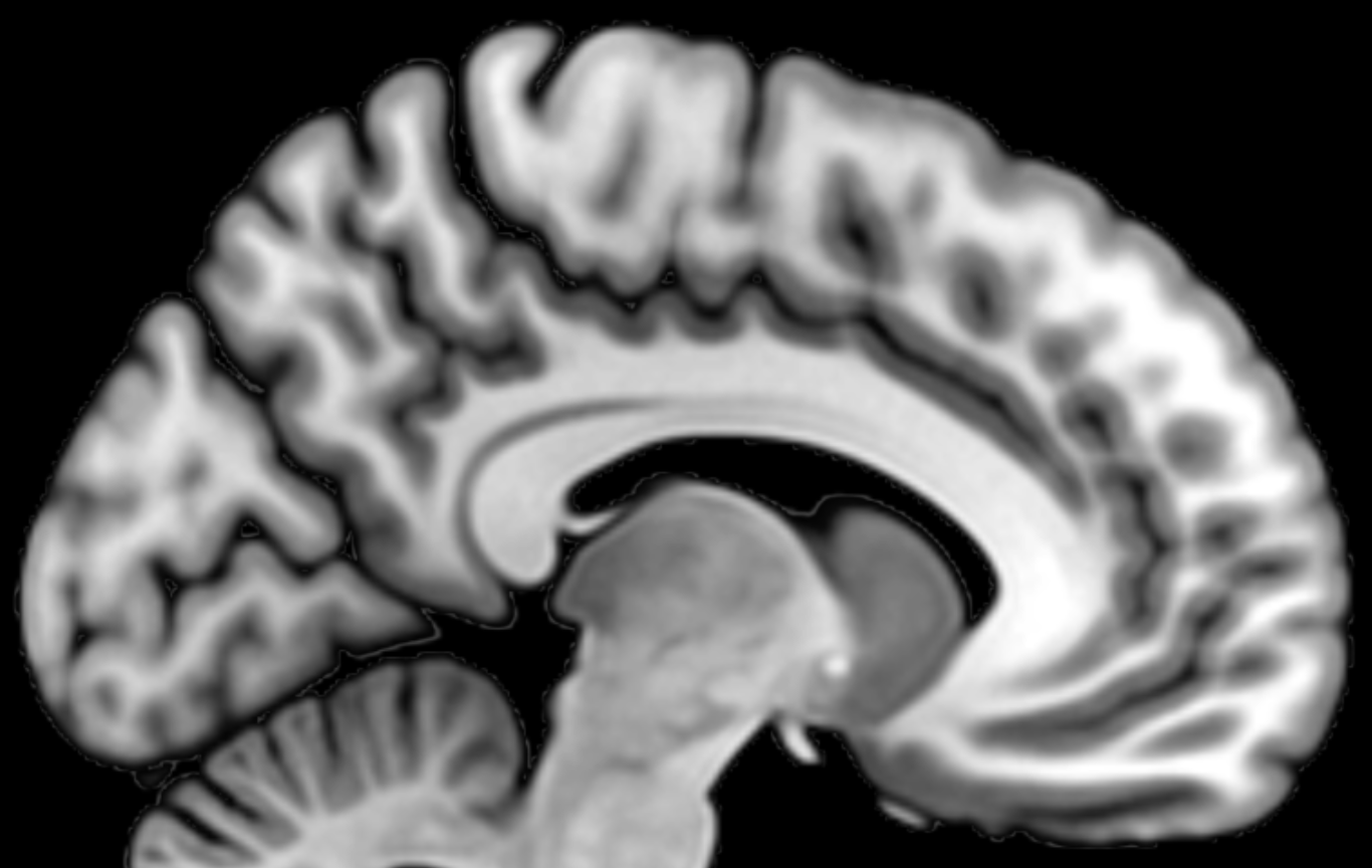 Magnetresonansavbildning av en hjärna. Montreal Neurological Institute 152, structural template image.