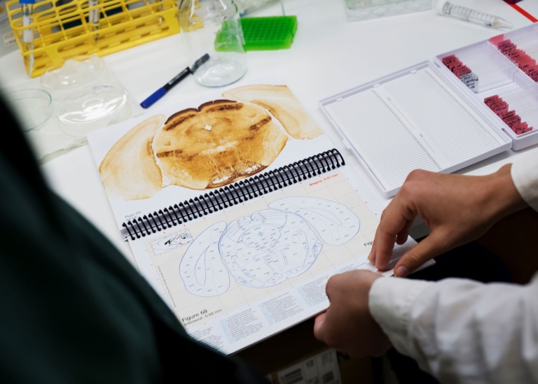 Grafisk karta över en hjärna