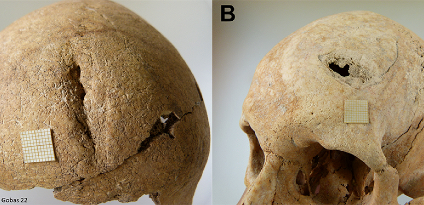 Skulls showing signs of violence. / Lourdes Herrasti