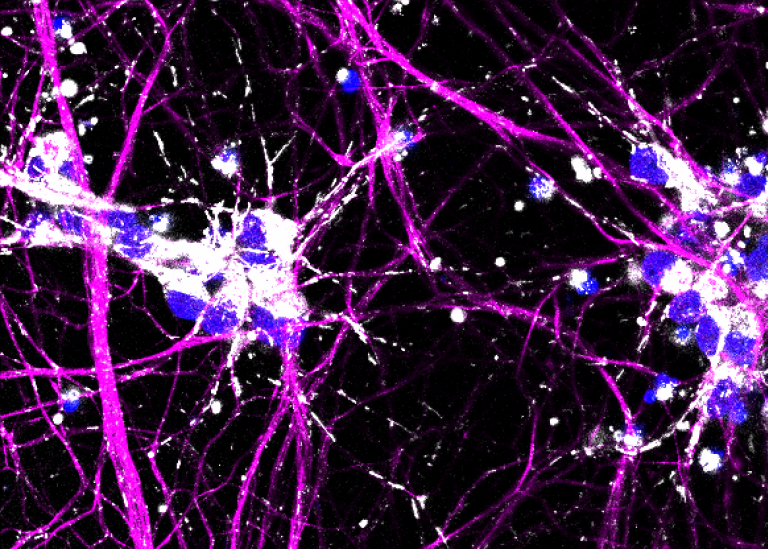 Purple neurons with mitochondria