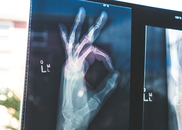 Skeletal hand making the sign for 'okay'