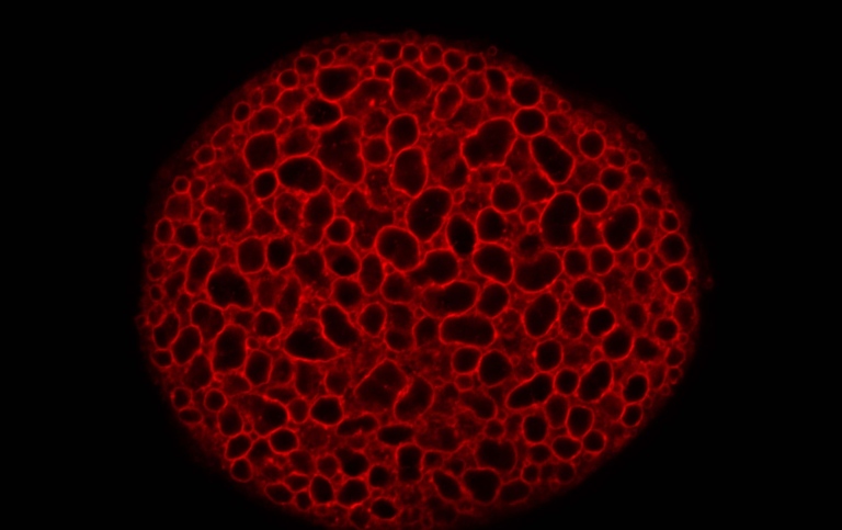 Celler från Drosophilas spottkörtel som uttrycker ett fluorescensmärkt protein