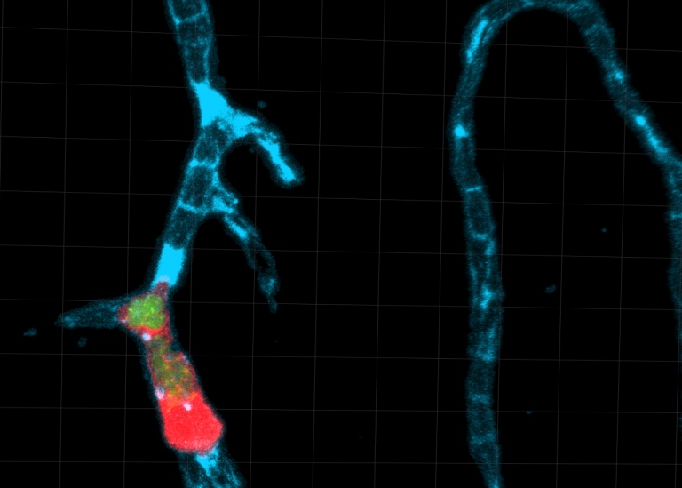 En immuncell med Toxoplasmaparasiter har fastnat i kärlväggen i en kapillär.
