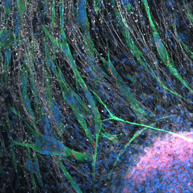 Neuro