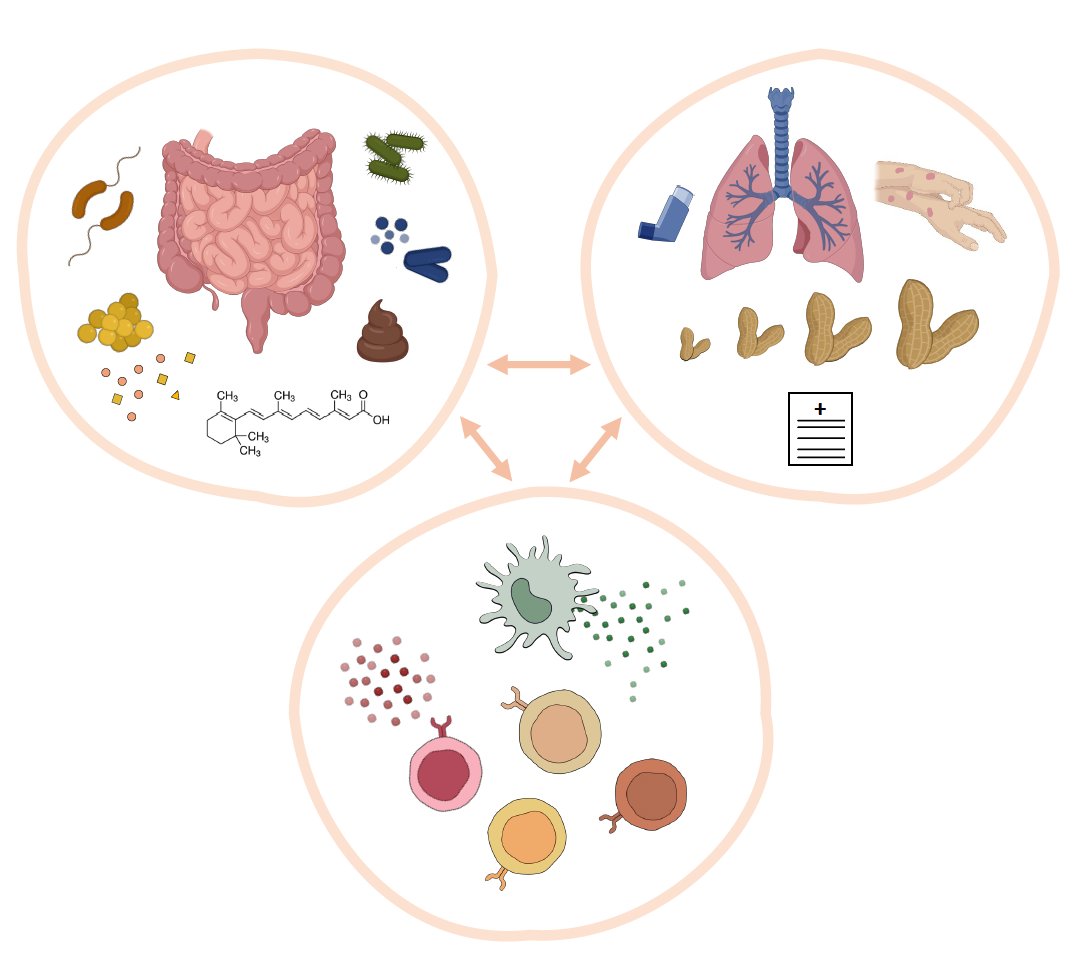 A photo that shows how the immune system, the gut microbiota, and allergic disease are interconnected