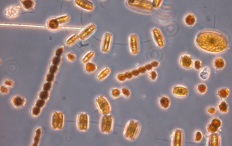 Mikroskopiska växtplankton