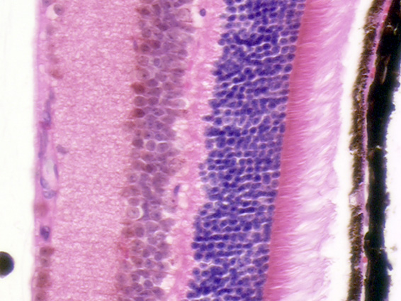 Human retina stained with hematoxylin and eosin