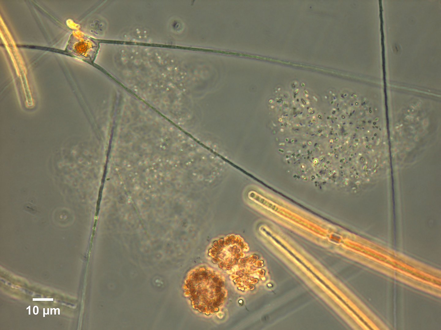 Micrograph of the phytoplankton studied.