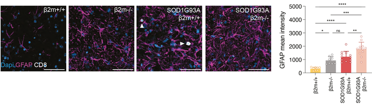 Removing b2m resulted in an activation of astrocytes in healthy mice and even further in ALS mice.