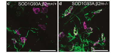 Removing the b2m gene in ALS mice resulted in partial preservation of synapses between motor neurons and muscle in particular muscles.