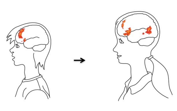 Pencil drawing of two young people with brain areas highlighted with color