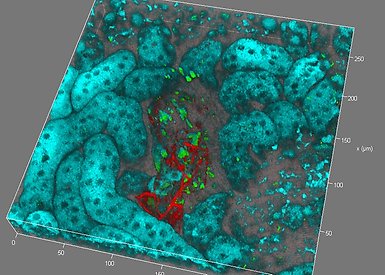 FITC mCherry Autofluorescence
